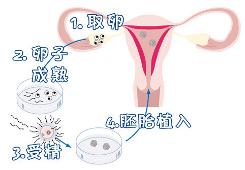 生殖中心